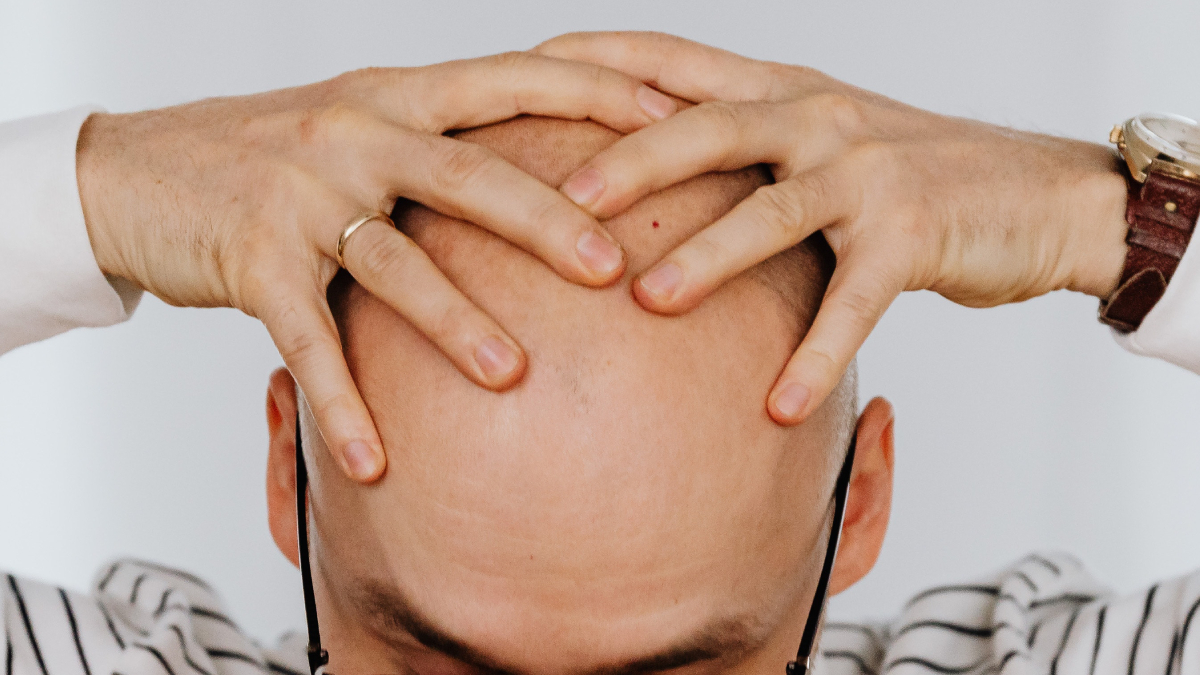 balding
