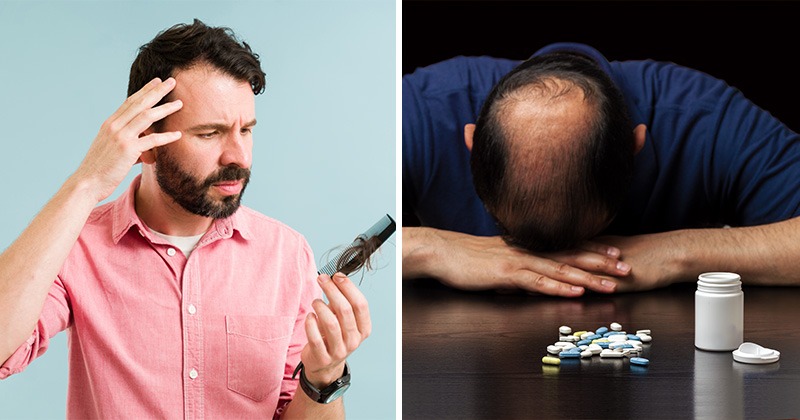 hair loss